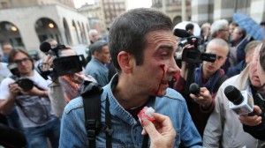 manifestante ferito brescia pdl centri sociali