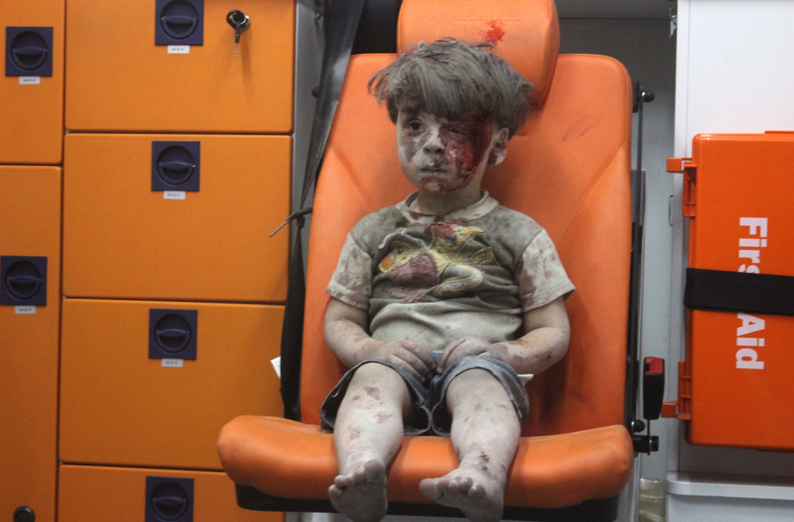 Omran Daqneesh