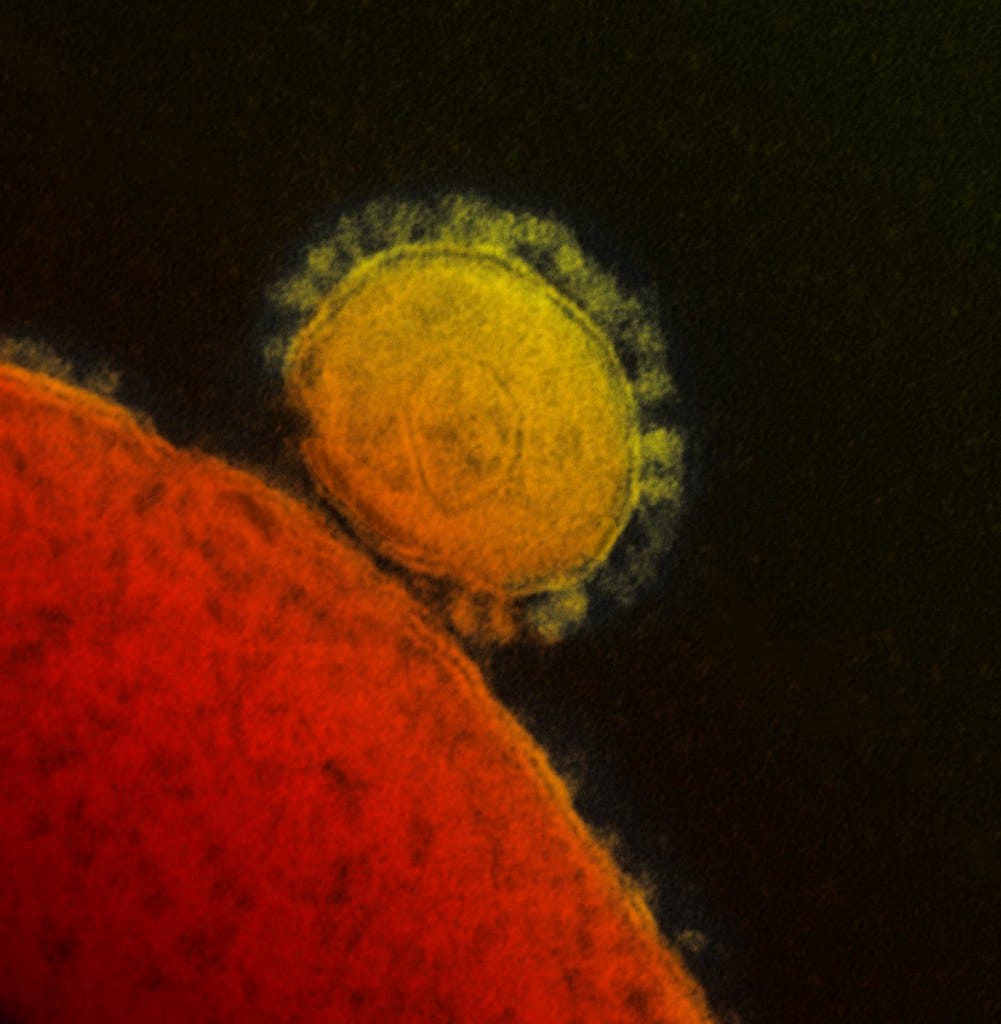 Coronavirus