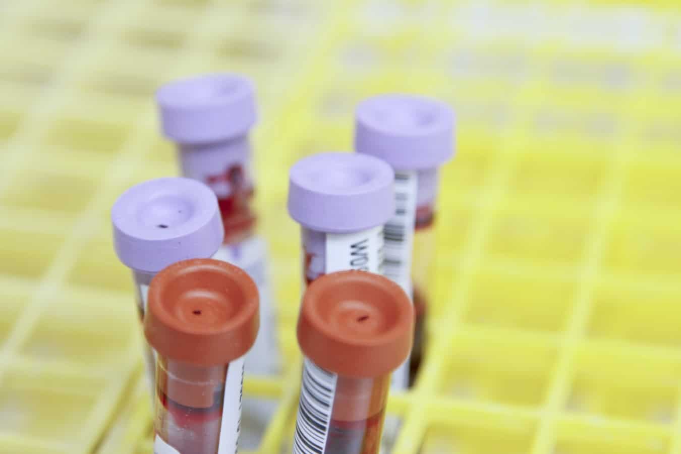 Provette di laboratorio di analisi