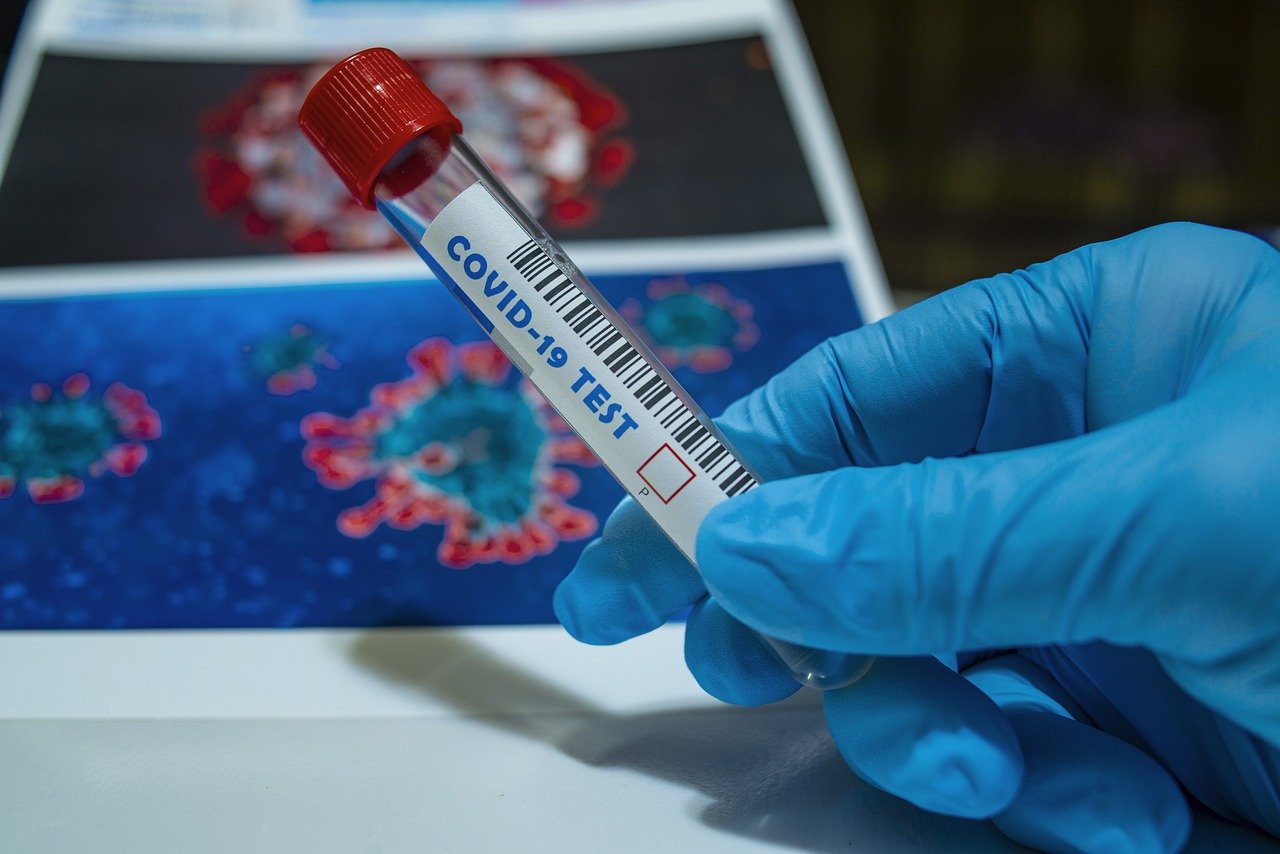 Coronavirus ultime notizie tracce virus acqua dicembre