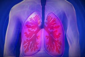 Tumore ai polmoni